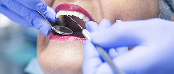 Best Emergency Wisdom Teeth Removal in Seven Lakes, NC